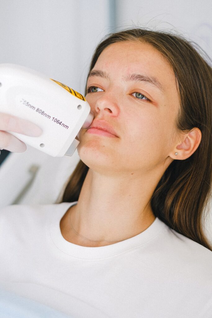 laser for hyperpigmentation