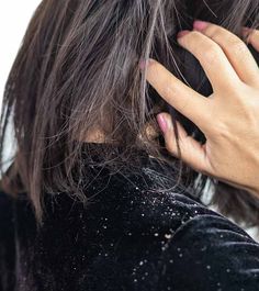 types of dandruff